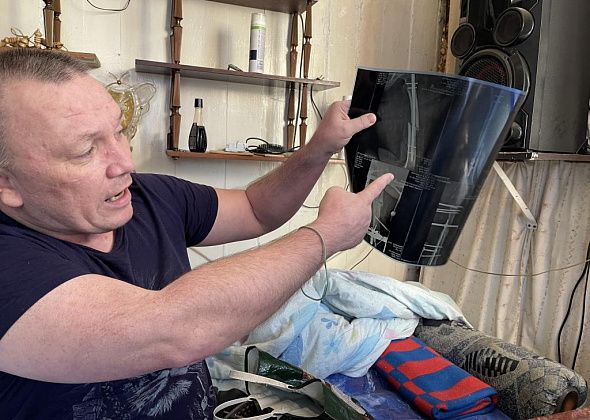Проблемой серовчанина со сложным переломом ног занялась городская прокуратура 